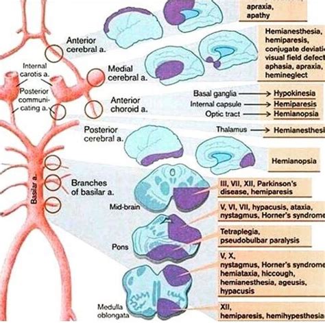 Spinal cord lesions – Artofit