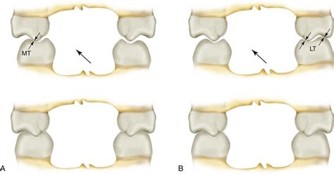 19. Selective Grinding | Pocket Dentistry