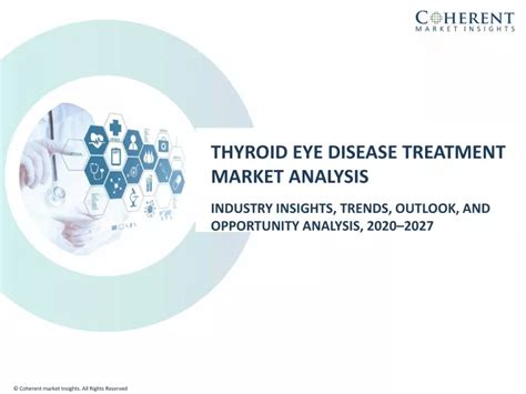 PPT Thyroid Eye Disease Treatment Market Size Trends Shares