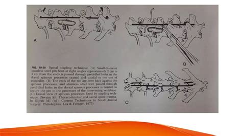 Spinal Instabilitypptx