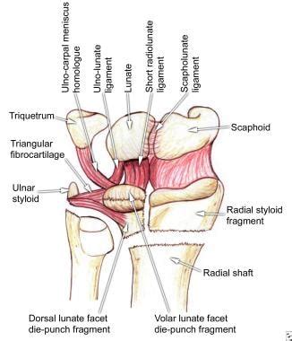 Muscle And Tendon Injuries Includes Injuries To Tendons And Ligaments