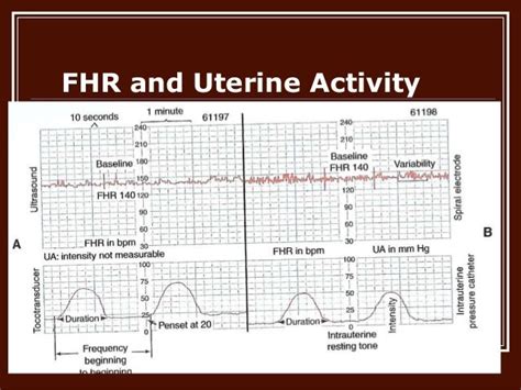 Normal Uterine Action