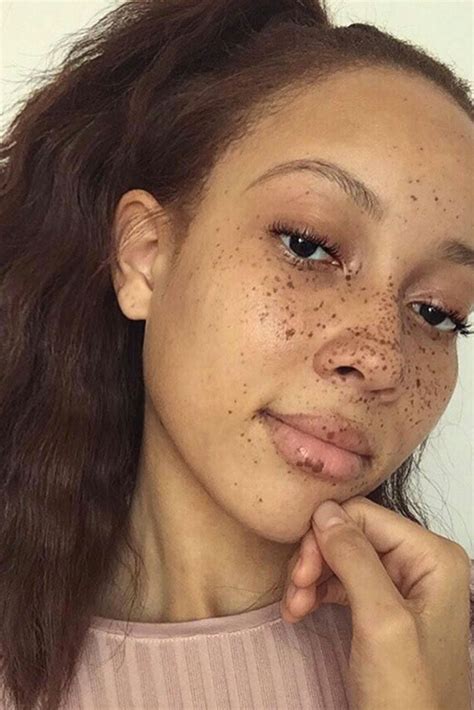 Beautiful Black Women With Freckles Essence