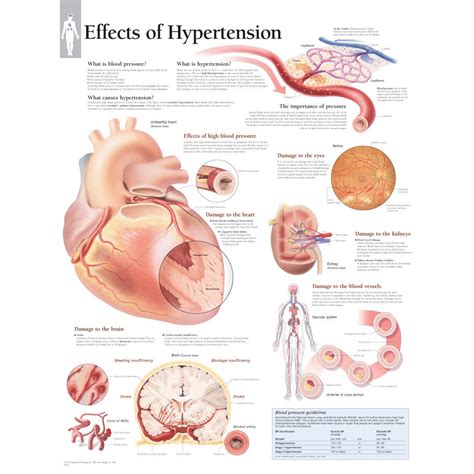 Scientific Publishing Effects Of Hypertension Chart