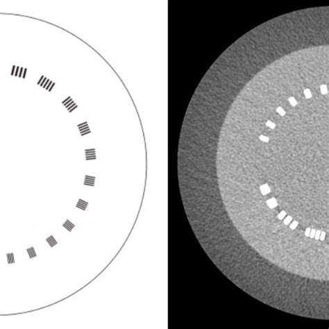 Module Ctp404 Of The Catphan 504 Phantom Download Scientific Diagram