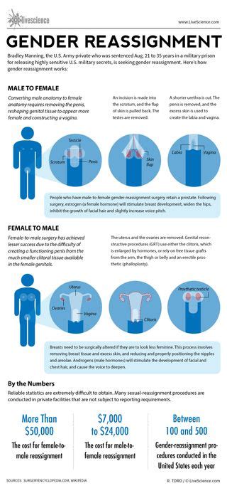 How Gender Reassignment Surgery Works Infographic Live Science