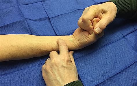 Muscle Test And Tendon Exam Flexor Carpi Radialis Fcr Hand Surgery Resource