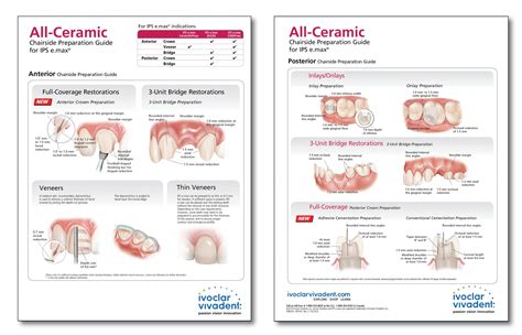 Emax Restorations • Triad Dental Studio