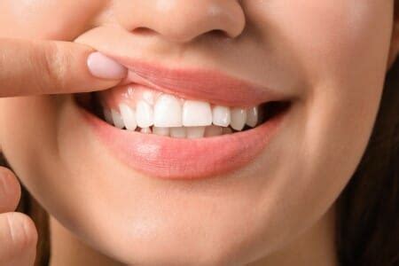 Ways To Keep Your Gums Healthy Gum Disease Prevention