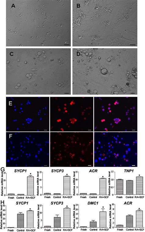 Morphological And Phenotypic Characteristics Of Human Sscs Without Or