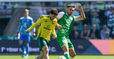 Warren O Hora Hoping For Hibs Redemption Against Celtic As Summer