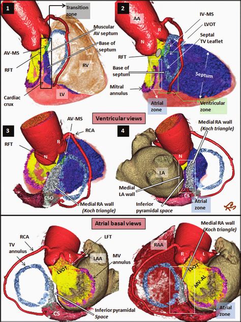 Building Blocks Of The Septal Atrioventricular Junction Region