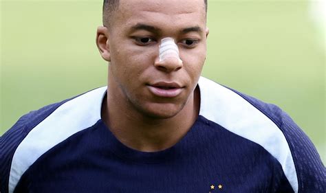 Sem máscara Mbappé aparece curativo no nariz no treino da França