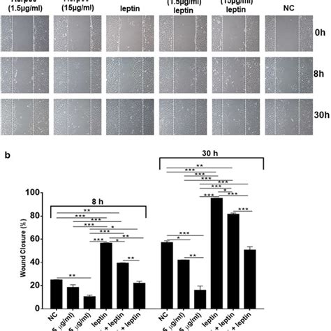 Acrp And Leptin Exert Antagonizing Effects On Bcpap Cell Migration A