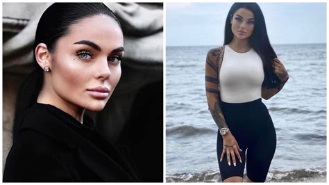 Камилла смогулецка фото до и после пластики
