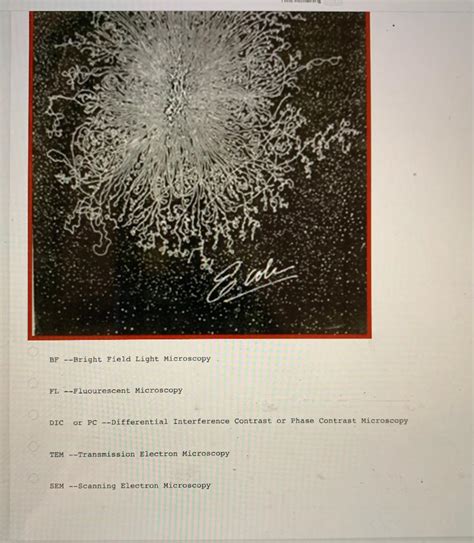 Solved Examine This Micrograph Of An Escherichia Coli Chegg