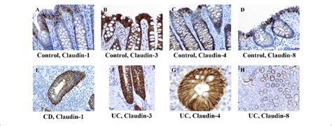 Claudin 1 Claudin 3 Claudin 4 And Claudin 8 Expression Patterns Of