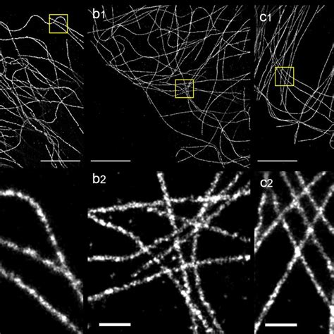 Test Of Several 750 Nm Excited Fluorophores On α Tubulin A Cf 750 Download Scientific