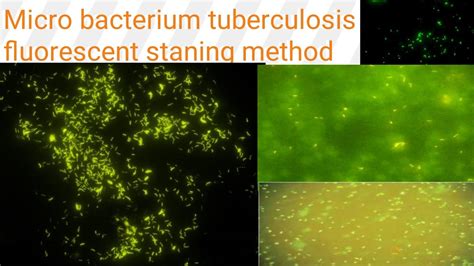 Auramine Rhodamine Staining On Fluorescent Microscopy Diagnosis Of Tb