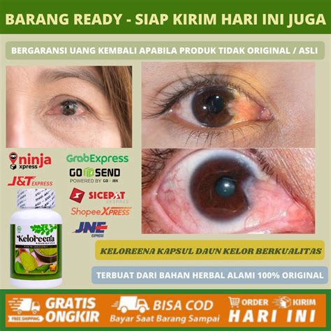 Jual Obat Mata Berlemak Ptregium Kekuningan Penghilang Selaput Putih