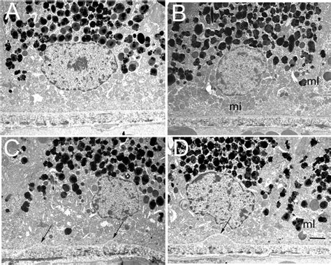 A D Show Electron Micrographs Of Retinal Pigment Epithelial Cells From