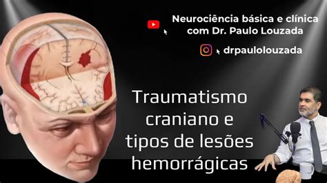 Traumatismo Craniano E Tipos De Les Es Hemorr Gicas Youtube