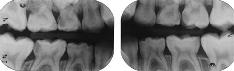 10 Dental Radiography Pocket Dentistry