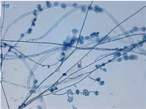 Micro Lab Final Yeast And Mold Flashcards Quizlet