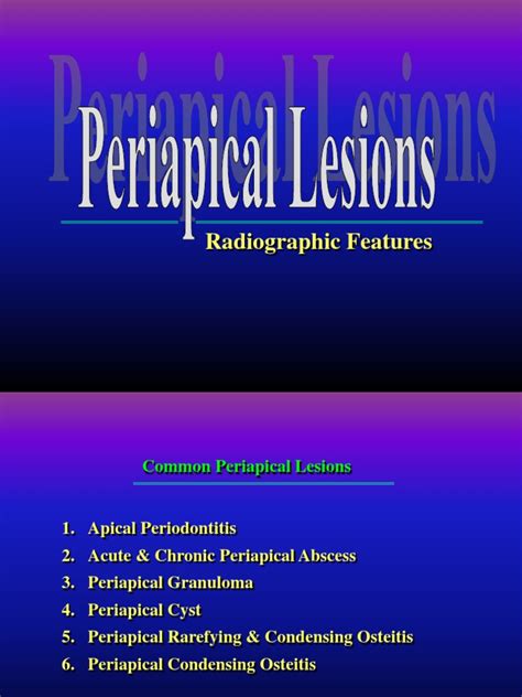 Pdf Periapical Lesions Dokumen Tips