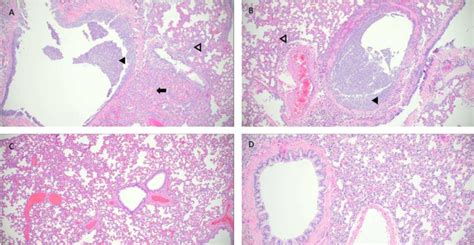 Pathological Findings In Hamster Lungs Representative Histology Of