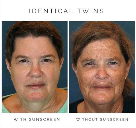 The Myths And Truths About Sunscreen Wave Skin Care