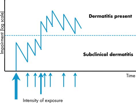 Current Concepts Of Irritant Contact Dermatitis Occupational And Environmental Medicine