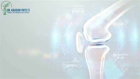 Comparison Of Robotic Knee Replacement Outcomes To Traditional Knee Replacement Outcomes By Dr