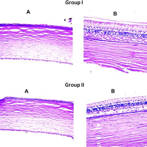 Photomicrographs Showing Histopathological Sections Hematoxylin And