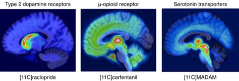 Dopamine Receptors In The Brain