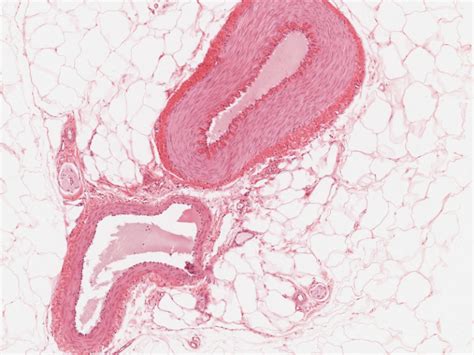 Histology Of Vein