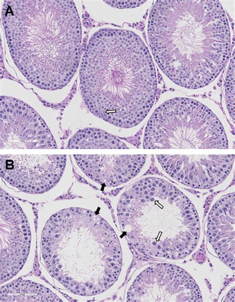 Testis Histology Labeled