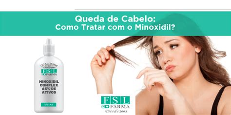 Queda De Cabelo Como Tratar O Minoxidil