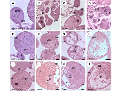 Histological Sections Of Rhipicephalus Sanguineus Ovary Stained By H E