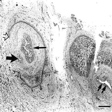 Fusion of embryos tissues, not blood chimerism. DNA from blood showed ...