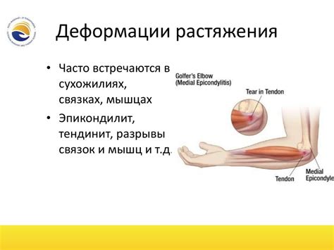 Кинезиология. Биомеханика. ОДА - презентация онлайн
