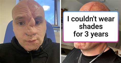 18 Transformations That Prove Surgeons Are Literally Magicians Bright