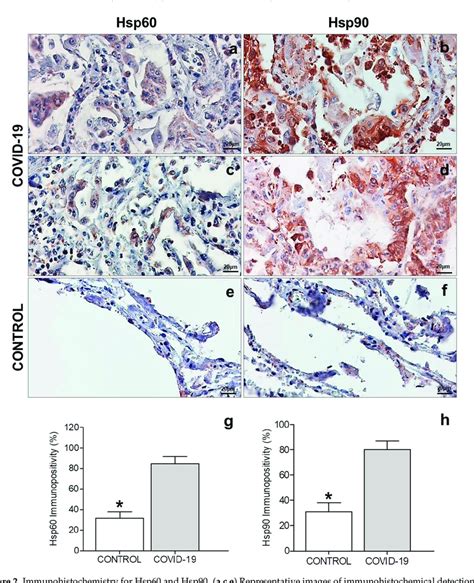 Immunohistochemistry For Hsp60 And Hsp90 A C E Representative Images