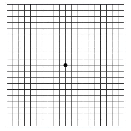 Large Amsler Grid Printable