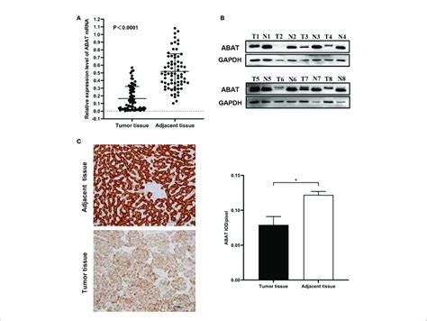 Expression Of Abat In Hcc A Qrt Pcr P