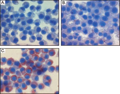 Foam Cell Formation Assayed By Oil Red O Staining J774 Macrophages