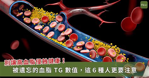 除了膽固醇，更該關注三酸甘油酯！詳解「高三酸甘油酯症」 東生華製藥
