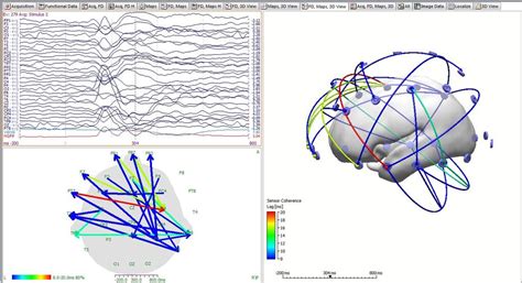 Curry Impedance Check Compumedics Neuroscan