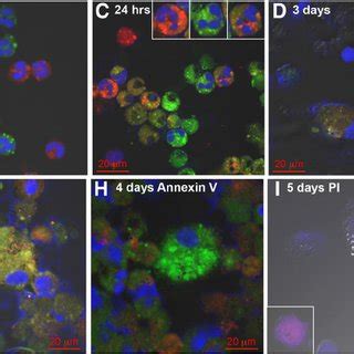 Ros Production By G Freshly Isolated Neutrophils And Cultured