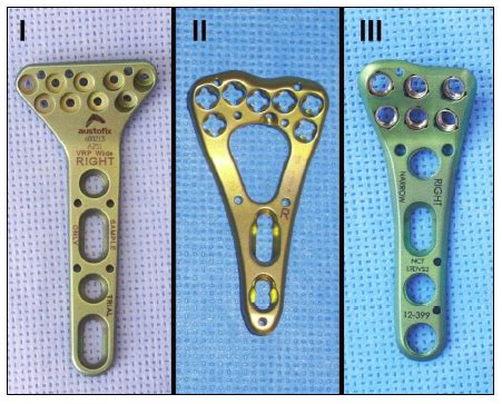 SciELO Brasil ANATOMICAL STUDY OF VOLAR FACE OF DISTAL RADIUS AND